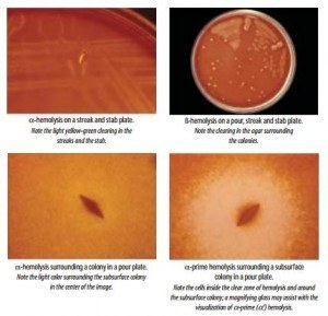 Various types of Hemolysis - Various types of Hemolysis