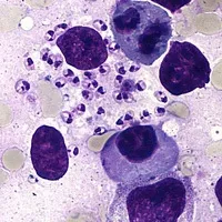 Amastigote form of Leishmania (LD Bodies) - Amastigote form ofLeishmania(LD Bodies)
