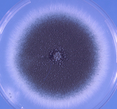  - colonies of A.fumigatus with typical blue-green surface pigmentation on Czapek doxagar(Source)﻿