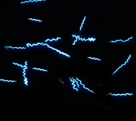 Borrelia appearance in dark field microscopy. Image courtesy S Bhimji MD - Borrelia in dark field microscopy(Image courtesy S Bhimji)