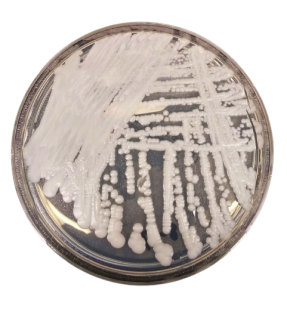 Candida auris colonies - Candida auriscolonies