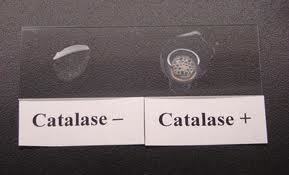 catase test - Catalase Test: Positive and Negative results