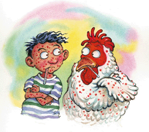 chicken pox cartoon - Chicken pox?