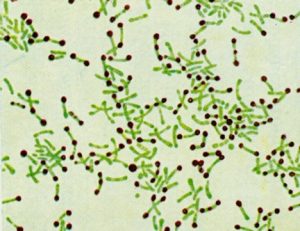 Metachromatic granules of Corynebacterium spp - Metachromatic granules ofCorynebacterium spp