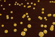 - Colonies ofCryptococcus neoformansin birdseed agar