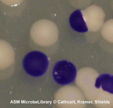  - Oxidase-positive Vibrio choleraeshowing purple colonies, and oxidase-negative Escherichia coliwith lack of color change