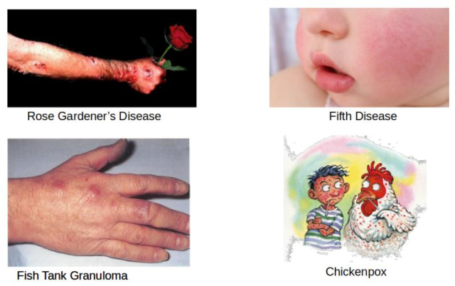 Interesting Disease Name