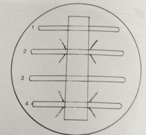 Elek test for demonstration of toxin production by C. diphetheriae  - Elek test for demonstration of toxin production byC. diphtheriae