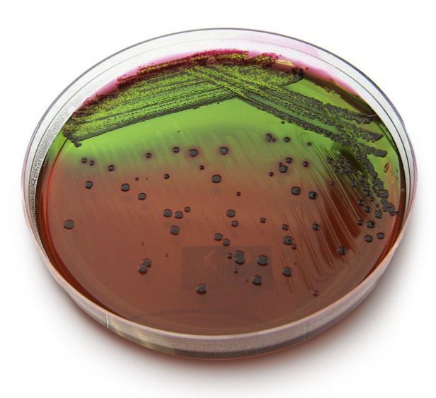 EMB Agar - Escherichia colicolonies in Eosin Methylene Blue Agar(Note: Greenish Metallic Sheen)