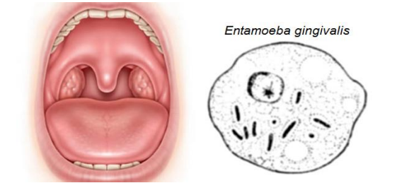 - Entamoeba gingivalesas typical endocommensal.