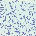 Enterococcus in gram-stain - Enterococcus faecalisin gram stain