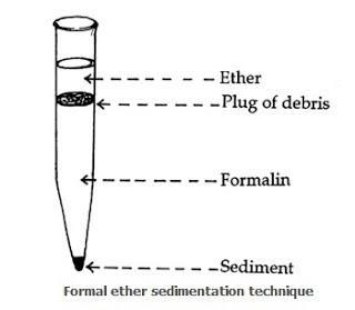Formal Ether Sedimentation Technique - Fig-1: Formal Ether Sedimentation Technique