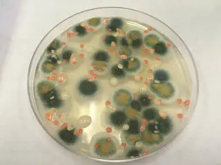 Microbes from space cultured in petridish - This photo shows a petri dish containing colonies of fungi from the Microbial Tracking-1 experiment. The sample was collected on the International Space Station on May 15, 2015.