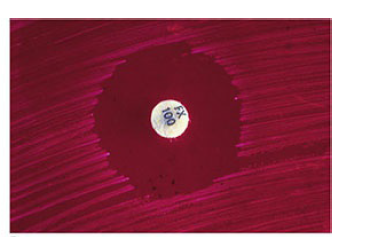 An area of growth inhibition of staphylococci around the furazolidone disk - An area of growth inhibition of staphylococci around the furazolidone disk