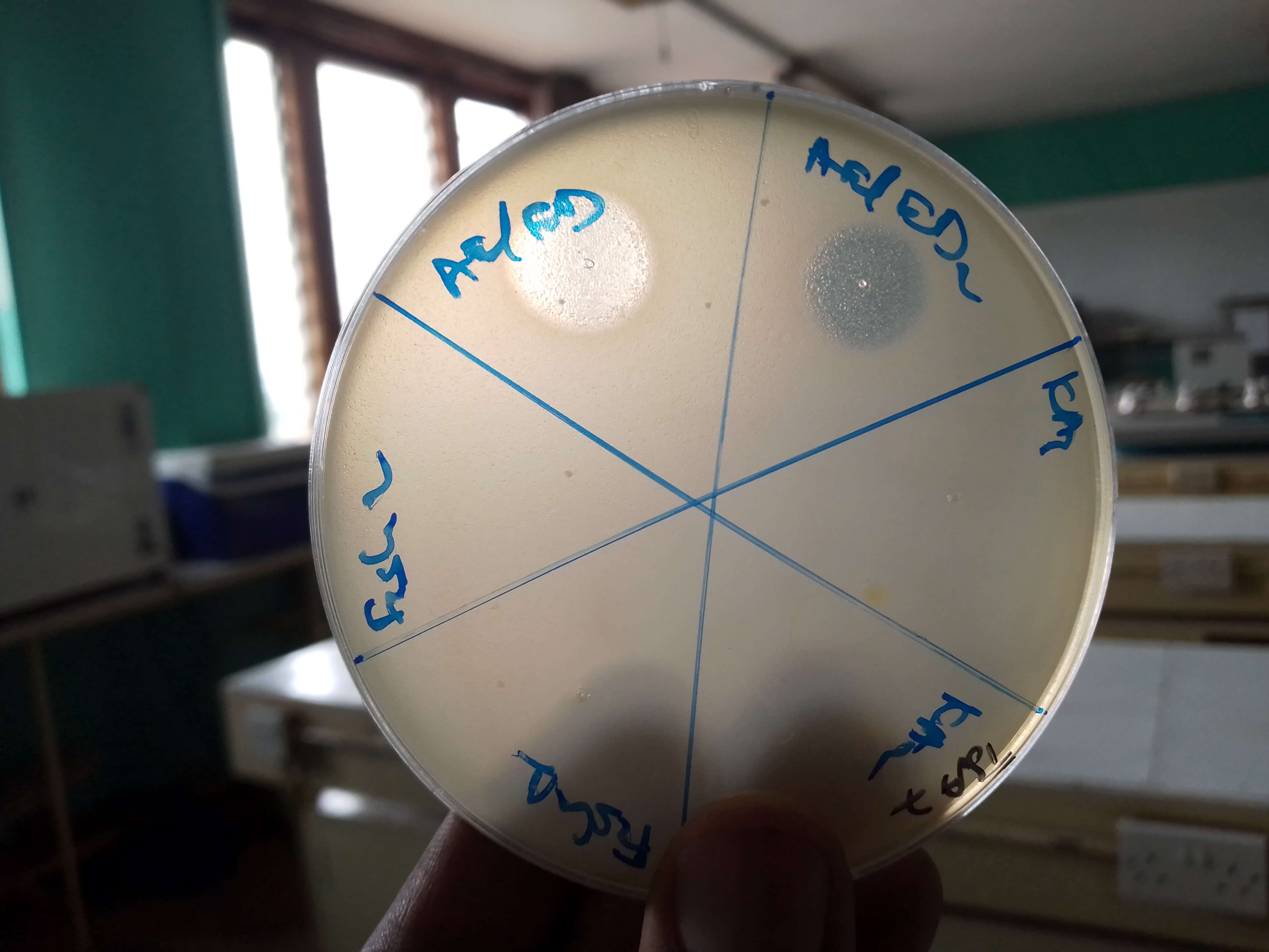  - A plate with a positive and negative spot assay test, with areas with transparent patches indicating bacteriophage activity on susceptible host bacteria. Taken by Raphael Hans Lwesya at Makerere University