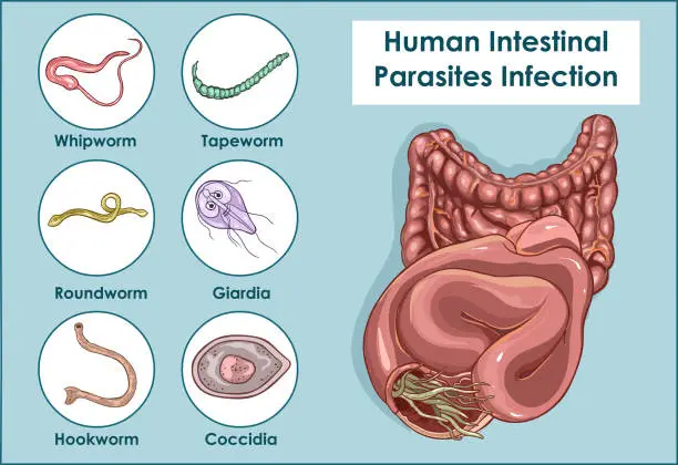 - Human Intestinal Parasites: Creator: corbac40 Credit: Getty Images/iStockphoto