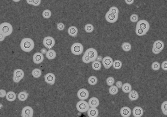 india ink fungal staining technique - Negative staining of Cryptococcal capsulesImage source:Doering lab