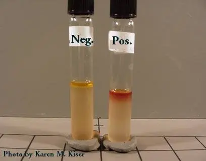 Indole Test - Indole Test Results: Positive-development of Red-ring
