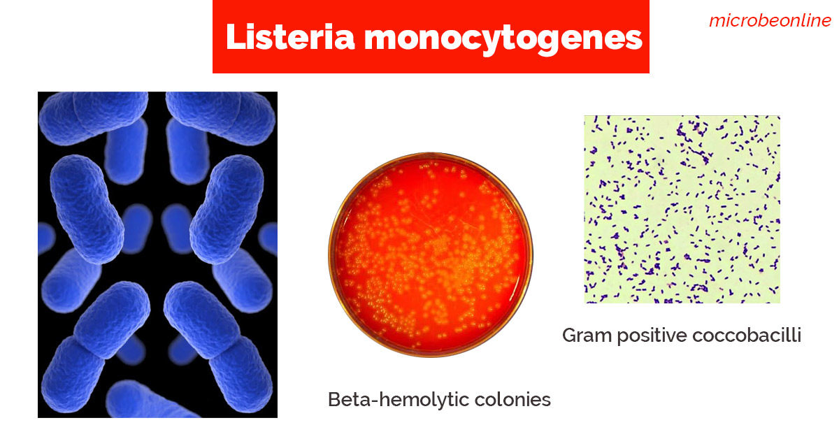 Listeria monocytogenes in Gram and Culture - Major characteristics ofListeria monocytogenes