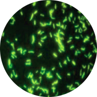 Mycobacteria in Fluorescent Microscopy
