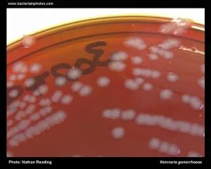 neisseria gonorrhoea on MNC - Neisseria gonorrhoeae in New York City Agar (LCAT).