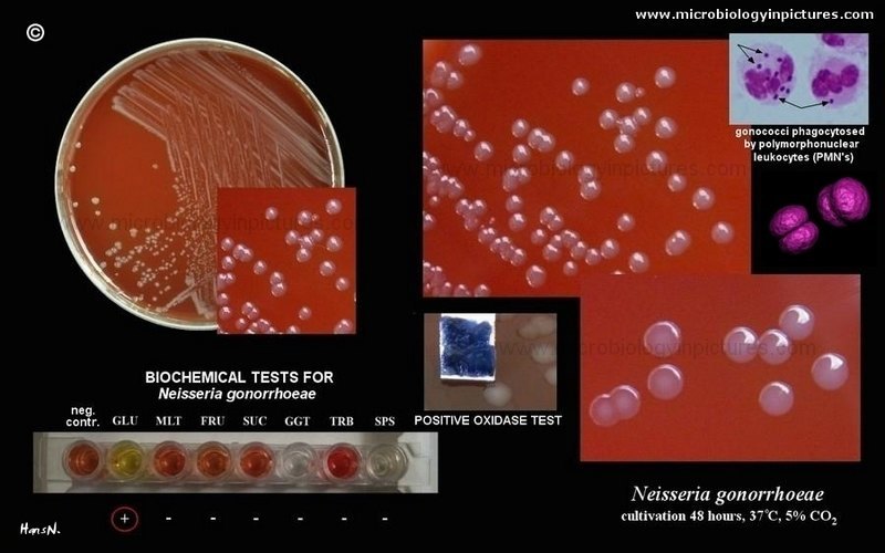 Neisseria gonorrhoeae morphology and culture - Neisseria gonorrhoeae(Image source: http://www.microbiologyinpictures.com/)