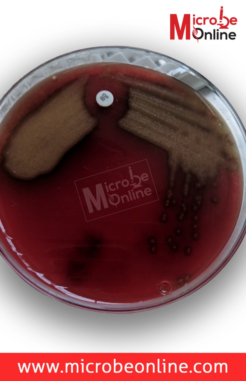Streptococcus pneumoniae with optochin sensitivity - Optochin sensitive colonies ofS. pneumoniae