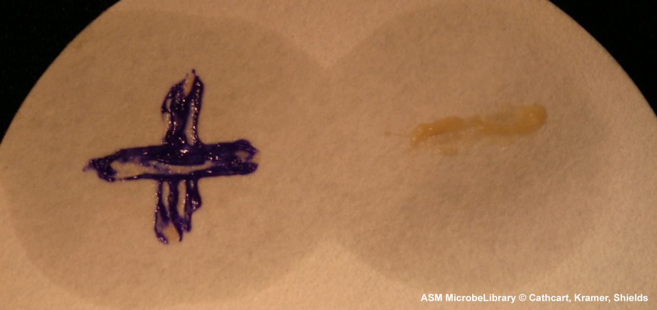 Oxidase test on filter paper - Oxidase-positivePseudomonas aeruginosa(left) andoxidase-negativeEscherichia coli(right).