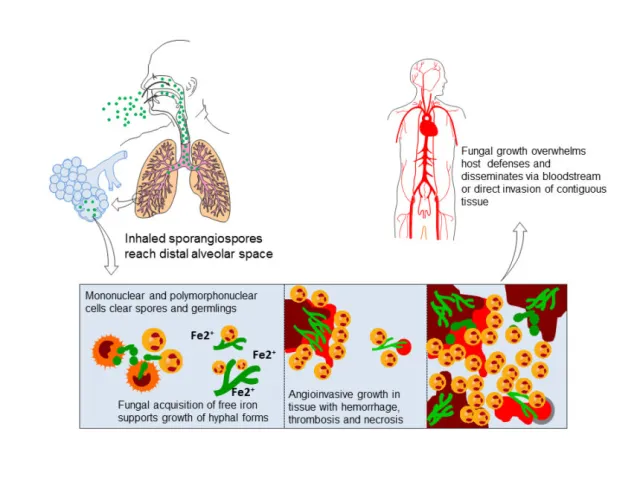  - Pathogenesis of pulmonary mucormycosis (Imagesource)