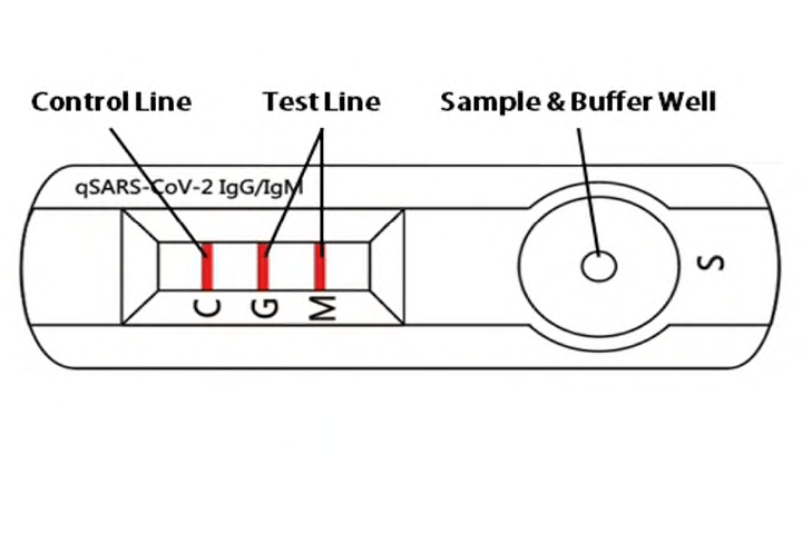 SARS-CoV-2 IgG/IgM assay - SARS-CoV-2 IgG/IgM assay