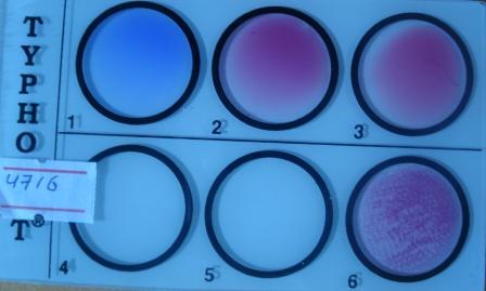 Widal Test Result: Sample (6) showing BH positive in screening test - Widal Test Result: Sample (6) showing BH positive in screening test
