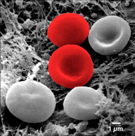 Image of RBCs obtained by scanning electron microscope - Image of RBCs obtained by SEM after artificial coloring. Images provided by the SEM are black and white. (Imagesource)