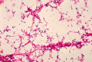 Streptococcus pneumoniae in Gram Staining  - Streptococcus pneumoniaein Gram Staining