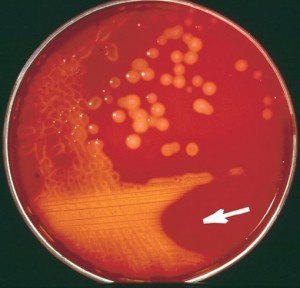 Blood agar showing β-hemolysis  - Blood agar showing β-hemolysis