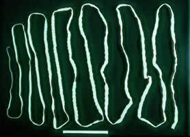 taenia saginata beef tapeworm - Taenia saginata(Beef tapeworm): CDC