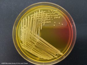 Yellow colonies of S. aureus in Mannitol Salt Agar (MSA). Image source: ASM - Yellow colonies ofS. aureusin Mannitol Salt Agar (MSA).Image source: ASM