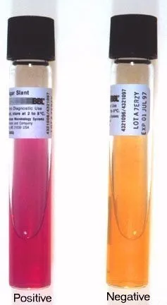 urease test - Urease Test Results