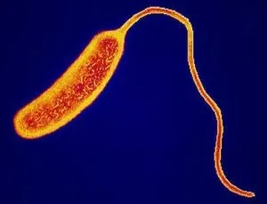 Bacterium Vibrio Cholerae which causes cholera - BacteriumVibrio choleraewhich causes cholera