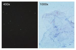 Comparison of ZN Staining an Flurochrome Staining - Comparison of ZN Staining and Flurochrome staining
