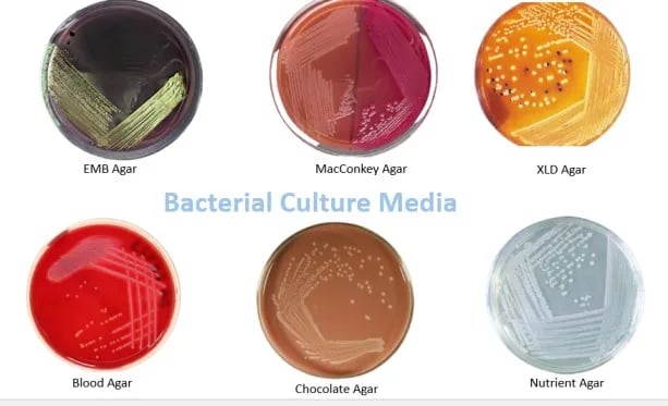 - Common bacterial culture media