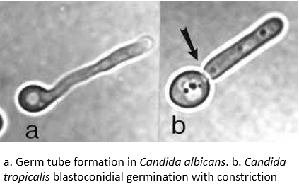 - Difference between pseudohyphae and germ tube