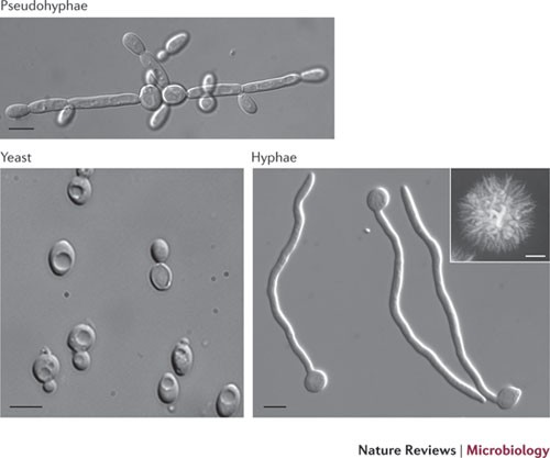 - Characteristics morphology ofCandida albicans