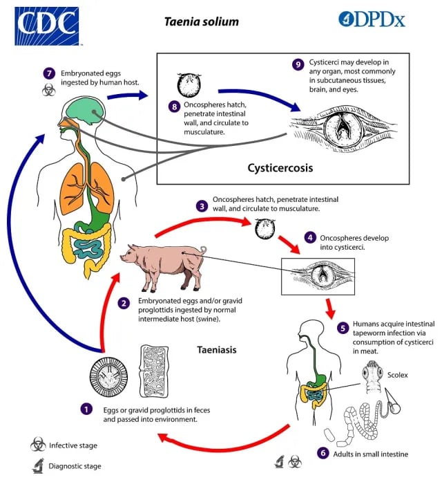 Life Cycle of Taenia Solium and Cysticercosis