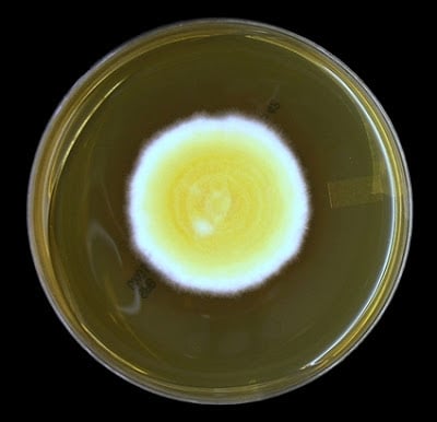 - Colonies ofBlastomyces dermatitidisin SDA after 7 days of growth  (Image source:http://thunderhouse4-yuri.blogspot.com/)