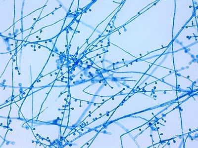 - “lollipop-like” conidiophore-conidia structures ofB. dermatitidis(Image source:http://thunderhouse4-yuri.blogspot.com/)