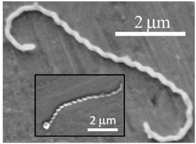 A scanning electron microscopy image of Leptospira interrogans The outer image is the