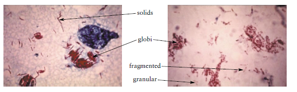 AFB (M. leprae) in skin smear  - AFB in skin smear