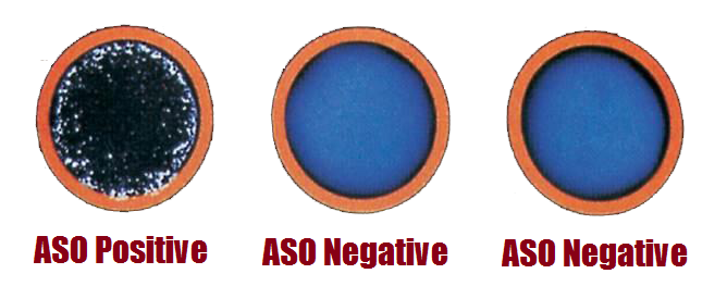 - ASO titer results