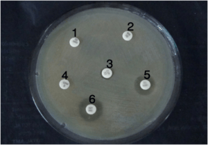- Antibiotic Sensitivity test: Multidrug-resistantE. colionMueller Hinton Agarisolated from urine sample (1=Amoxycillin, 2=Norfloxacin, 3=Ciprofloxacin, 4=Cefixime, 5=Gentamicin, 6=Nitrofurantoin). No clear zone (and very small clear zone) was seen around different antibiotic discs; this means the bacterial cells are not inhibited by multiple antibiotics.