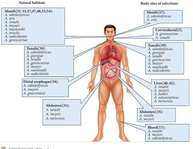 Actinomyces infection and normal flora